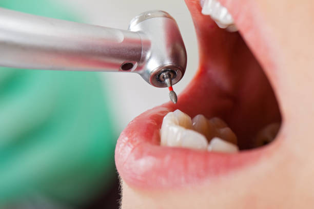 Best Cracked Tooth Emergency Dentist  in Mmaduke, AR